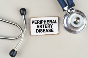 Peripheral artery disease